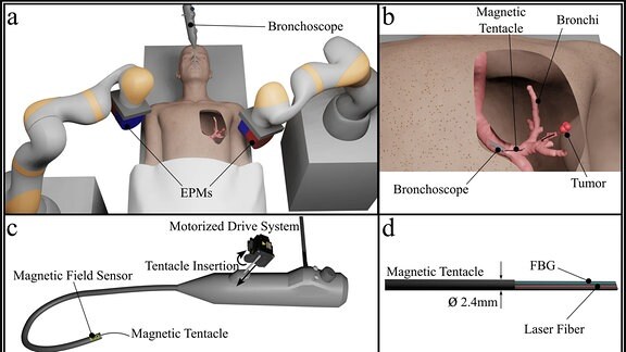 Beschreibung magnetischer Tentakelplattform