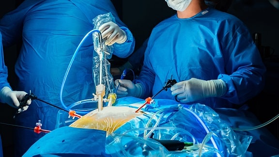 Minimalinvasiver laparoskopischer Eingriff