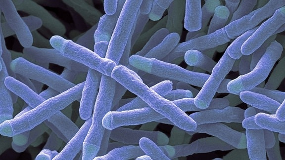 Mycobacterium smegmatis bacteria imago0065459494h.jpg