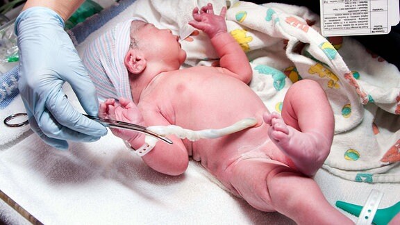 Neugeborenes süßes Baby mit Hand hält Clip auf Nabelschnur in einem Krankenhaus Kinderzimmer. 