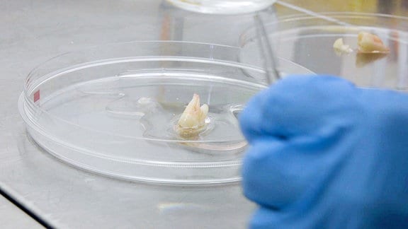 In einer Petrischale liegt ein Zahn. Eine Hand hält eine Pinzette über der Schale.