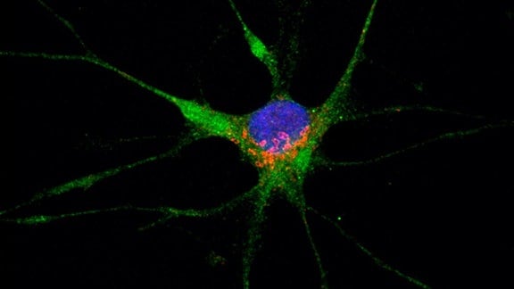 Farblich veränderte Mikroskopaufnahme einer Nervenzelle. Die grünen Bereiche sind Verbindungen zu anderen Nervenzellen (Astrozyten), blau ist der Kern der Zelle und die roten Bereiche zeigen Proteine des Sars-Coronavirus-2.