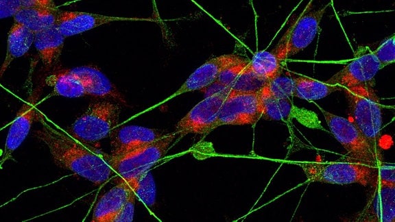 Eingefärbte Mikroskopaufnahme mit Nervenzellen (in Blau) und sogenannten dendritischen Zellen (grün), die die Verbindungen zwischen den Nervenzellen schaffen. In rot sind die Bereiche zu sehen, wo ACE-2 vorkommt.