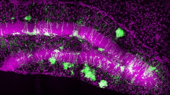 Gehirnzellen von Mäusen