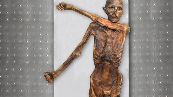 Mumie von oben auf einer Art Pritsche, Metallfläche drum herum. Linker Arm gerage über Brust hinweg nach rechts liegend, rechter Arm ausgestreckt nach schräg unten. 
