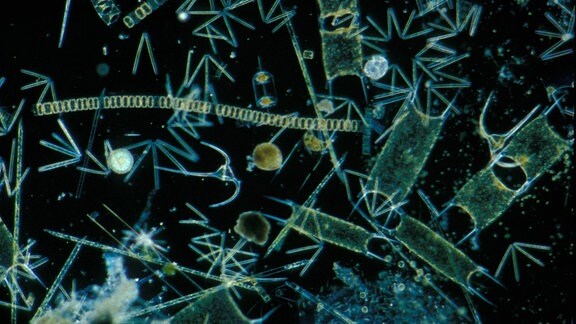 Makroaufnahme von Phytoplankton