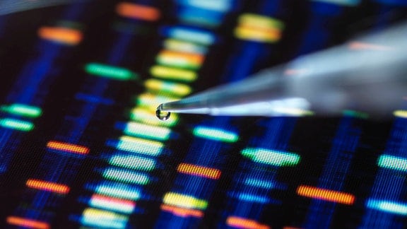 Pipettieren der Probe in die Schale für den DNA-Test