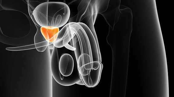 Schematische Darstellung mit weißen Linien vor schwarzem Hintergrund des männlichen Unterleibes, Position der Prostata unterhalb der Blase orange-rot hervorgehoben