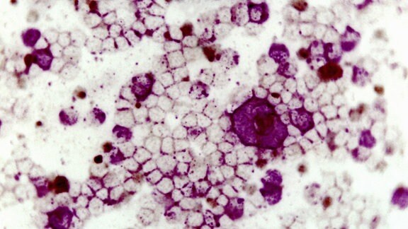 Mikrofotografie Respiratorisches Synzytial-Virus