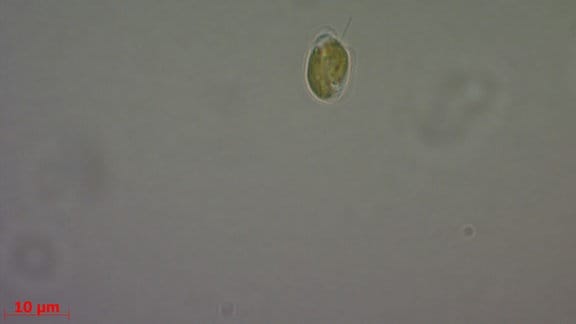 Lichtmikroskopische Aufnahmen einer Zelle der Alge Prymnesium parvum