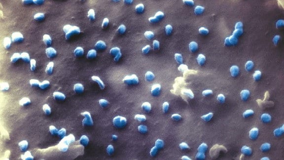Coronaviren (blau) beim Austritt aus einer Nierenzelle, aufgenommen mit einem Heliumionen-Mikroskop. 