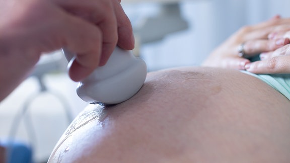 Arzt führt Ultraschalluntersuchung bei einer Schwangeren durch.