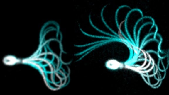 Schlagmusters eines Spermiums vor (l.) und nach (r.) CatSper-Aktivierung. Der kräftigere Schlag ist für die Befruchtung entscheidend.