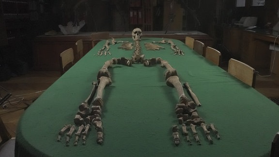 Die zusammengefügten Knochen eines Mannes auf einem Tische.