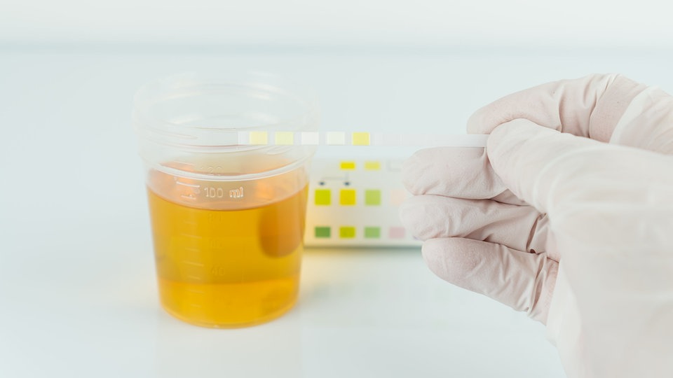 Warum ist Urin gelb? MDR.DE