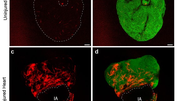 Vier Bilder mit einem Zebrafisch-Herz (grün, verletzt und unverletzt), die Zellen mit sox10-Gen sind beim verletzten Herz deutlich erkennbar
